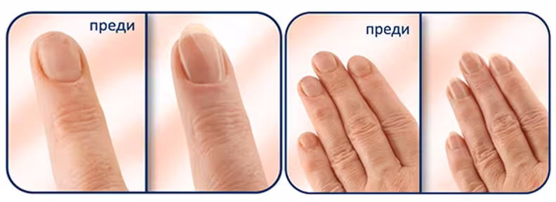 before-after-min-1