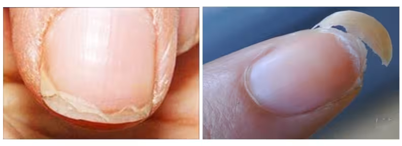 problem_nails-min-1